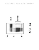 PREDICTIVE MARKER FOR TOPOISOMERASE I INHIBITORS diagram and image