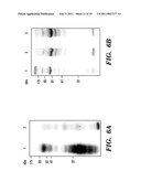 PREDICTIVE MARKER FOR TOPOISOMERASE I INHIBITORS diagram and image