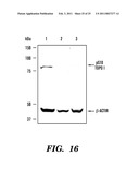 PREDICTIVE MARKER FOR TOPOISOMERASE I INHIBITORS diagram and image