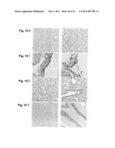 METHOD FOR TREATING SYNOVIAL SARCOMA diagram and image