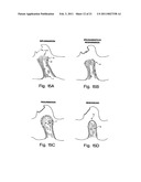 BIOLOGIC REPLACEMENT FOR FIBRIN CLOT diagram and image