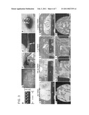 POROUS IMPLANTS AND STENTS AS CONTROLLED RELEASE DRUG DELIVERY CARRIERS diagram and image