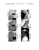 POROUS IMPLANTS AND STENTS AS CONTROLLED RELEASE DRUG DELIVERY CARRIERS diagram and image