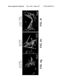 POROUS IMPLANTS AND STENTS AS CONTROLLED RELEASE DRUG DELIVERY CARRIERS diagram and image