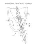 Multi-Layer Product With Sealing Areas Of Varying Temperature diagram and image