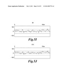 HIGHLY SENSITIVE METHOD FOR DETECTION OF VIRAL HIV DNA REMAINING AFTER ANTIRETROVIRAL THERAPY OF AIDS PATIENTS diagram and image