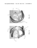 Stability Ball Control Device with Radial Control Surfaces of Increasing Widths diagram and image