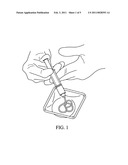 FLOWABLE PASTE AND PUTTY BONE VOID FILLER diagram and image