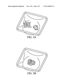 FLOWABLE PASTE AND PUTTY BONE VOID FILLER diagram and image