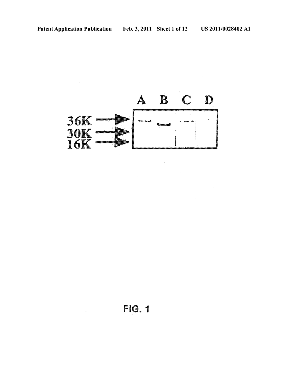 SUBSTANCE P-SAPORIN (SP-SAP) CONJUGATES AND METHODS OF USE - diagram, schematic, and image 02