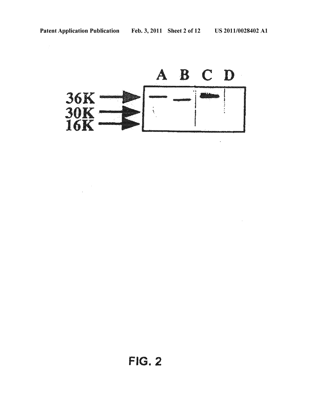 SUBSTANCE P-SAPORIN (SP-SAP) CONJUGATES AND METHODS OF USE - diagram, schematic, and image 03