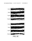 NUTRITIONAL COMPOSITIONS FOR PROMOTION OF BONE GROWTH AND MAINTENANCE OF BONE HEALTH COMPRISING EXTRACTS OF FOR EXAMPLE ROSEMARY OR CARAWAY diagram and image
