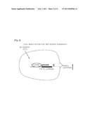 Pharmaceutical Composition For Preventintion And Treatment Of Restenosis Comprising Isoxazole Derivatives diagram and image