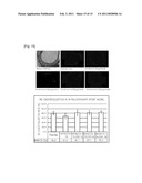 Pharmaceutical Composition For Preventintion And Treatment Of Restenosis Comprising Isoxazole Derivatives diagram and image