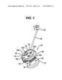 METHODS AND DEVICES FOR PROVIDING ACCESS INTO A BODY CAVITY diagram and image