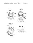 METHODS AND DEVICES FOR PROVIDING ACCESS INTO A BODY CAVITY diagram and image