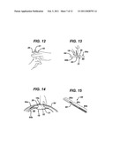 METHODS AND DEVICES FOR PROVIDING ACCESS INTO A BODY CAVITY diagram and image