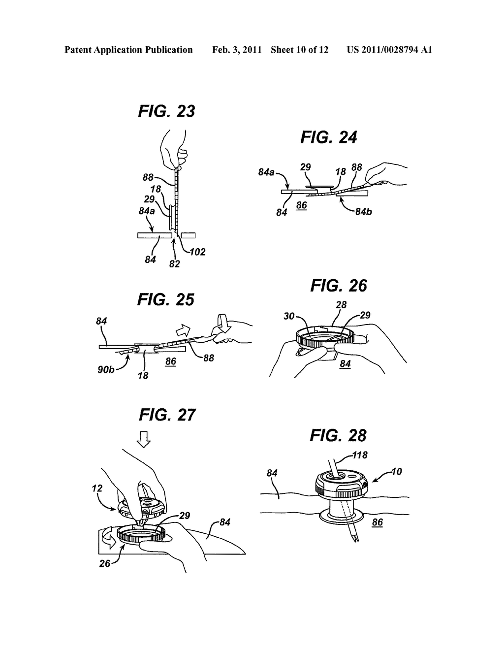 METHODS AND DEVICES FOR PROVIDING ACCESS INTO A BODY CAVITY - diagram, schematic, and image 11