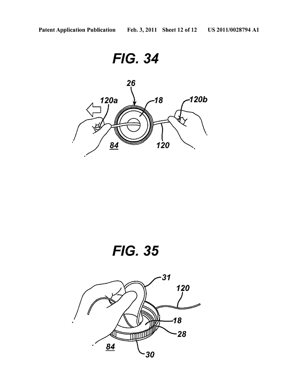 METHODS AND DEVICES FOR PROVIDING ACCESS INTO A BODY CAVITY - diagram, schematic, and image 13