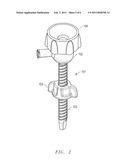 Cannula Anchor diagram and image