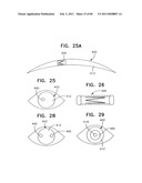 Contact lens for collecting tears and detecting at least one analyte diagram and image