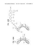 Contact lens for collecting tears and detecting at least one analyte diagram and image