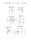 Contact lens for collecting tears and detecting at least one analyte diagram and image