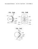 Contact lens for collecting tears and detecting at least one analyte diagram and image