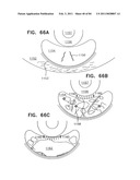 Contact lens for collecting tears and detecting at least one analyte diagram and image