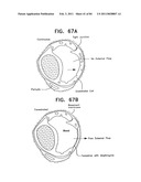 Contact lens for collecting tears and detecting at least one analyte diagram and image