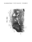 Contact lens for collecting tears and detecting at least one analyte diagram and image