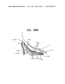 Contact lens for collecting tears and detecting at least one analyte diagram and image