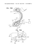 Contact lens for collecting tears and detecting at least one analyte diagram and image