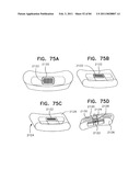 Contact lens for collecting tears and detecting at least one analyte diagram and image