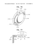 Contact lens for collecting tears and detecting at least one analyte diagram and image