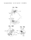 Contact lens for collecting tears and detecting at least one analyte diagram and image