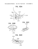 Contact lens for collecting tears and detecting at least one analyte diagram and image