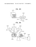 Contact lens for collecting tears and detecting at least one analyte diagram and image