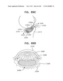 Contact lens for collecting tears and detecting at least one analyte diagram and image