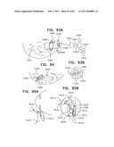 Contact lens for collecting tears and detecting at least one analyte diagram and image