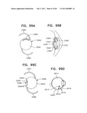 Contact lens for collecting tears and detecting at least one analyte diagram and image