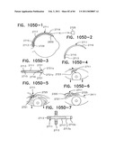 Contact lens for collecting tears and detecting at least one analyte diagram and image