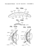 Contact lens for collecting tears and detecting at least one analyte diagram and image