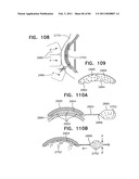 Contact lens for collecting tears and detecting at least one analyte diagram and image