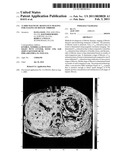 T1 RHO MAGNETIC RESONANCE IMAGING FOR STAGING OF HEPATIC FIBROSIS diagram and image