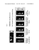 T1 RHO MAGNETIC RESONANCE IMAGING FOR STAGING OF HEPATIC FIBROSIS diagram and image