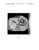 T1 RHO MAGNETIC RESONANCE IMAGING FOR STAGING OF HEPATIC FIBROSIS diagram and image