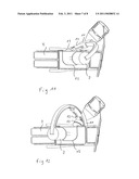 Shock wave therapy apparatus having an integrated X-ray device diagram and image