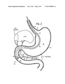 METHODS AND APPARATUSES FOR ENDOSCOPIC RETROGRADE CHOLANGIOPANCREATOGRAPHY diagram and image