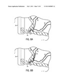 METHODS AND APPARATUSES FOR ENDOSCOPIC RETROGRADE CHOLANGIOPANCREATOGRAPHY diagram and image